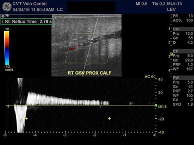 Ultrasound assessment